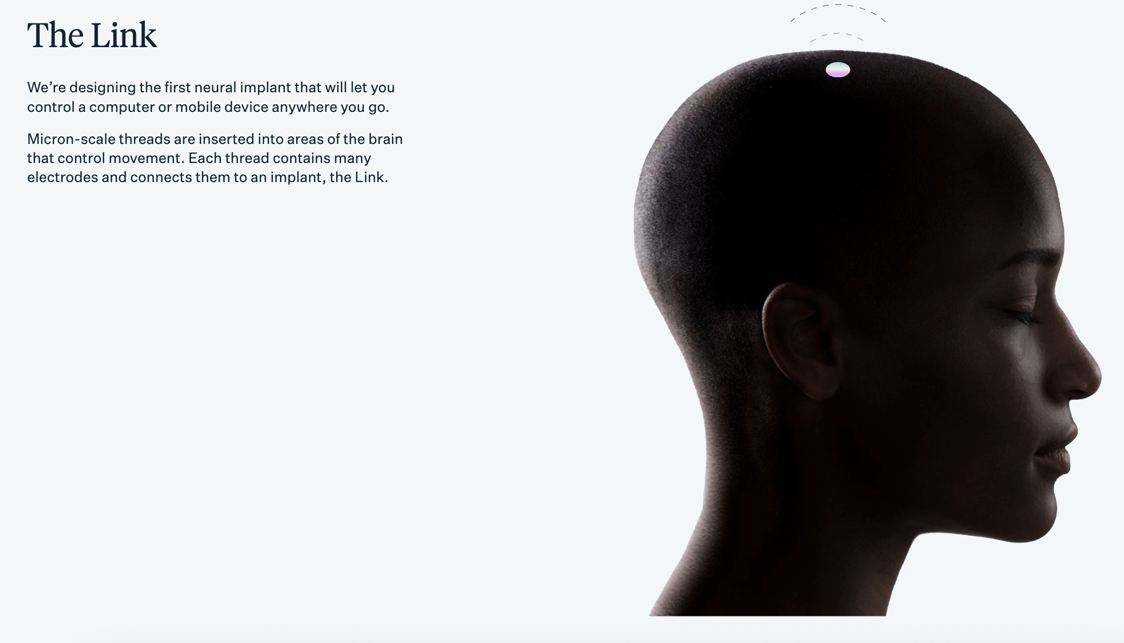 Neuralink — The Link neural implant